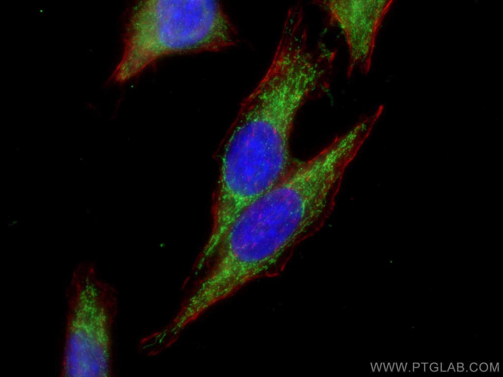 ACSM2A Polyclonal antibody