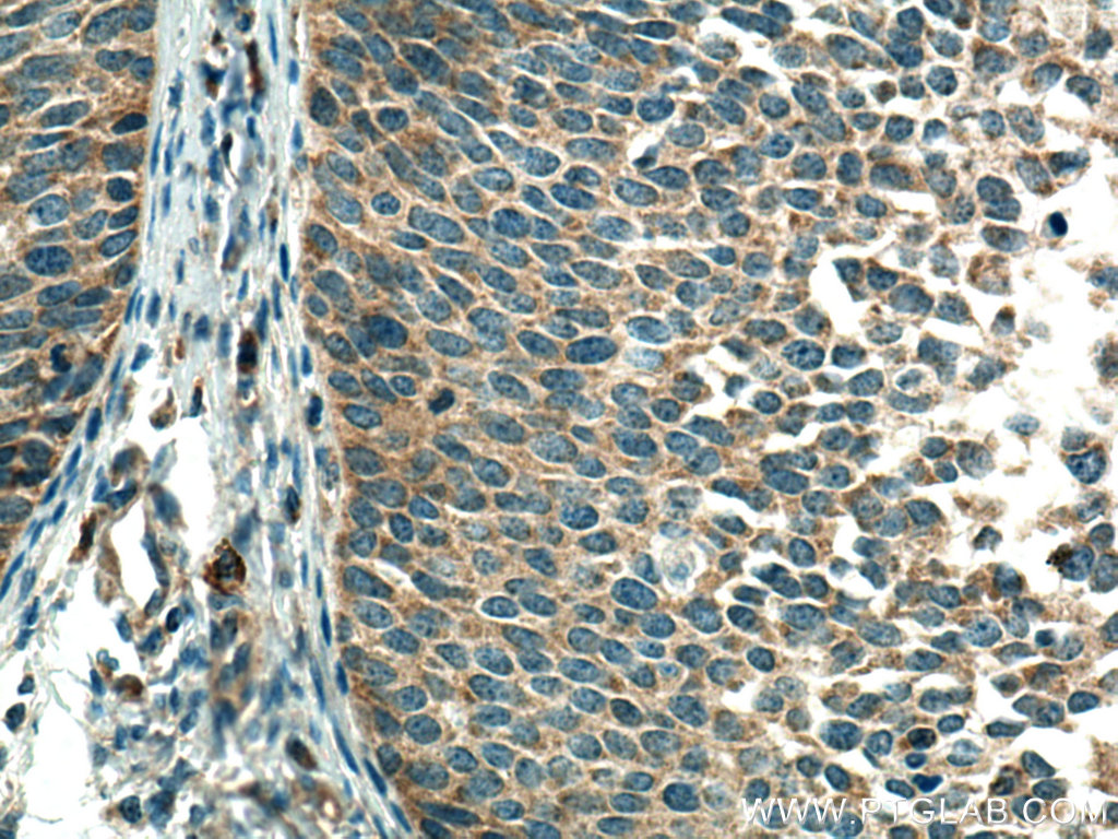 CSAD Polyclonal antibody