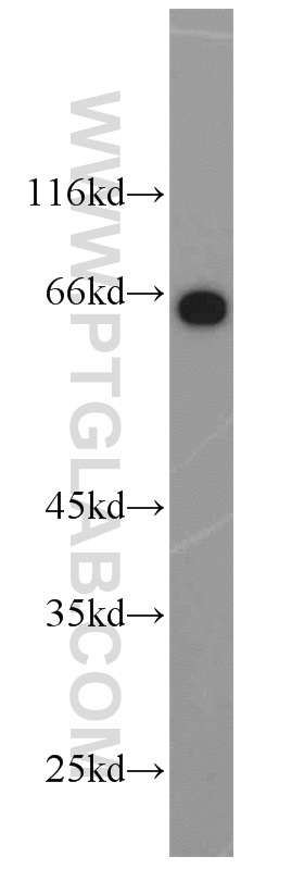 HSF4 Polyclonal antibody