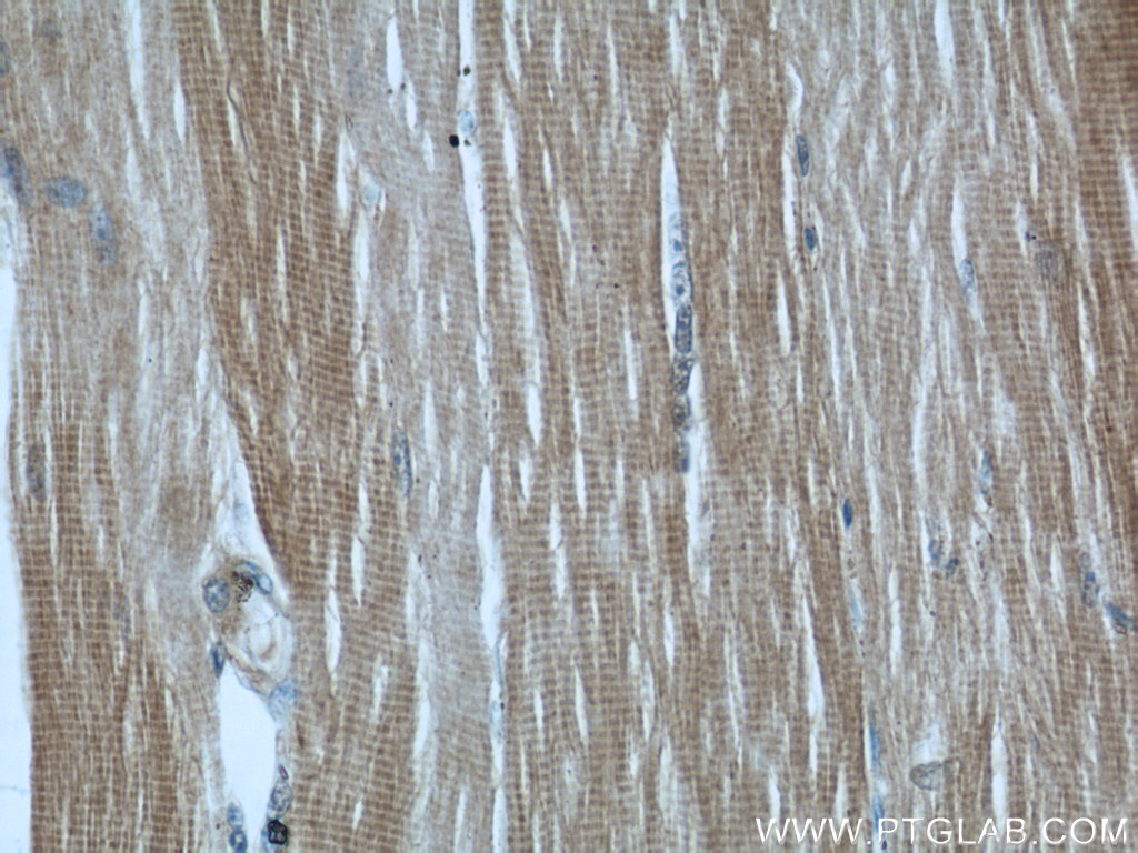 MYBPC1 Polyclonal antibody