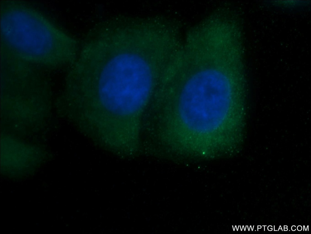 SHE Polyclonal antibody