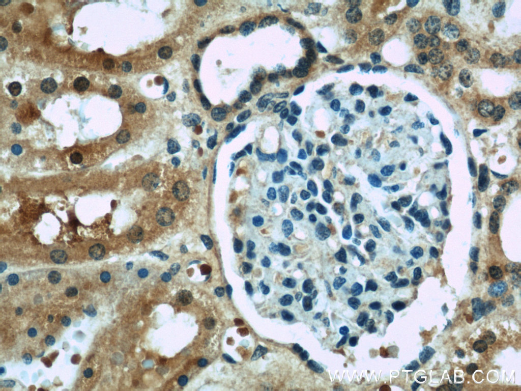 ACOT6 Polyclonal antibody