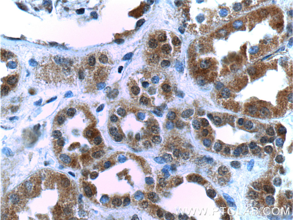SIX5 Polyclonal antibody