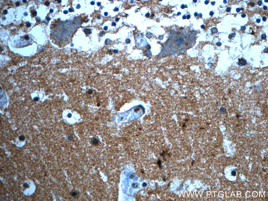 PRODH Polyclonal antibody