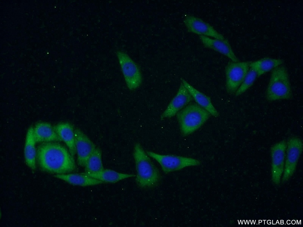 CDKAL1 Polyclonal antibody