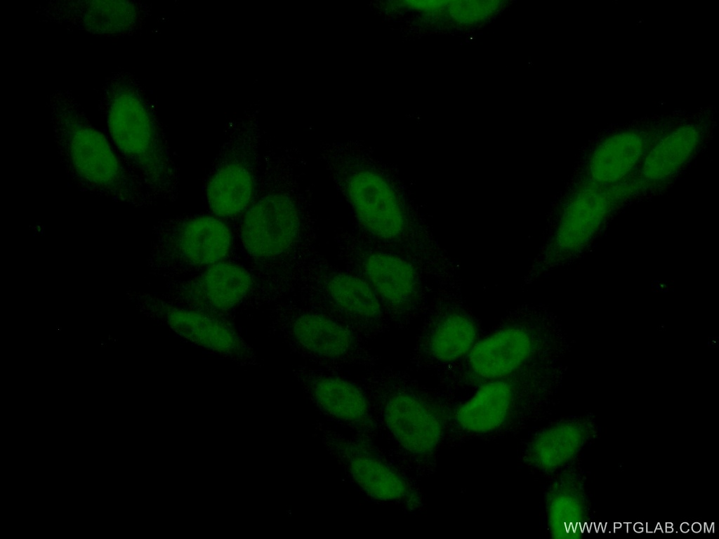SCP3 Polyclonal antibody