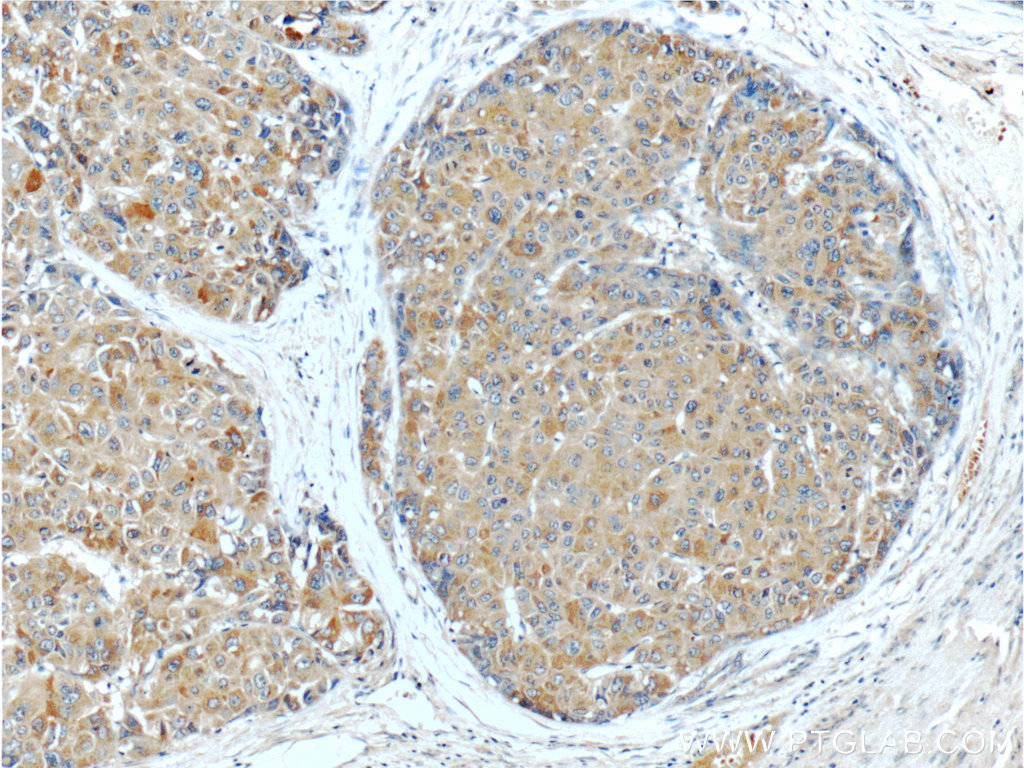 PGLYRP2 Polyclonal antibody