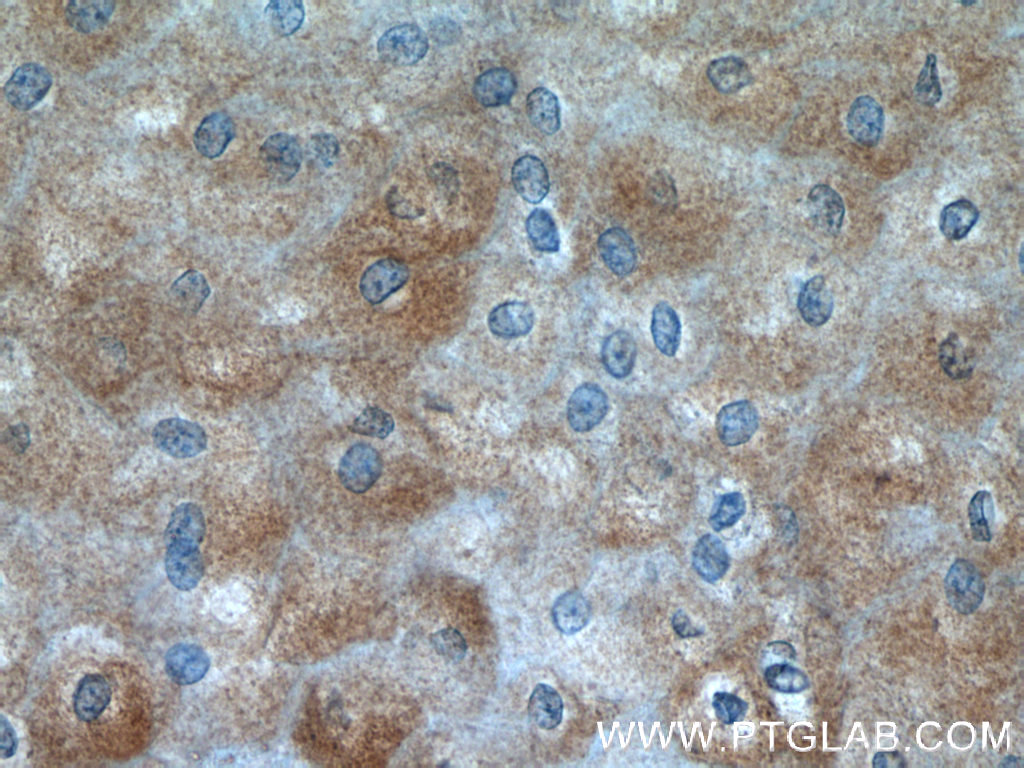 SPRR2D Polyclonal antibody