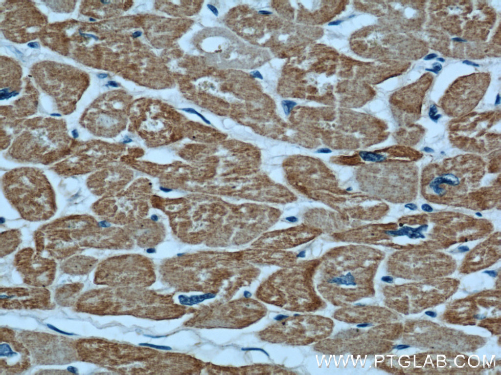 Alpha Actin Polyclonal antibody