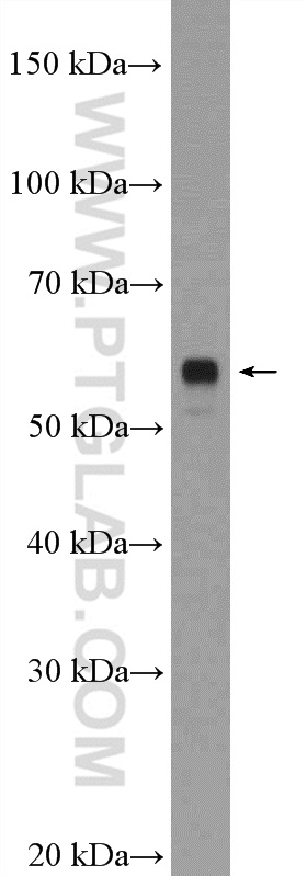 LRRTM2 Polyclonal antibody