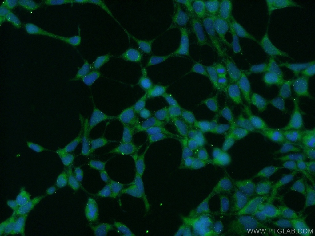ZRANB3 Polyclonal antibody