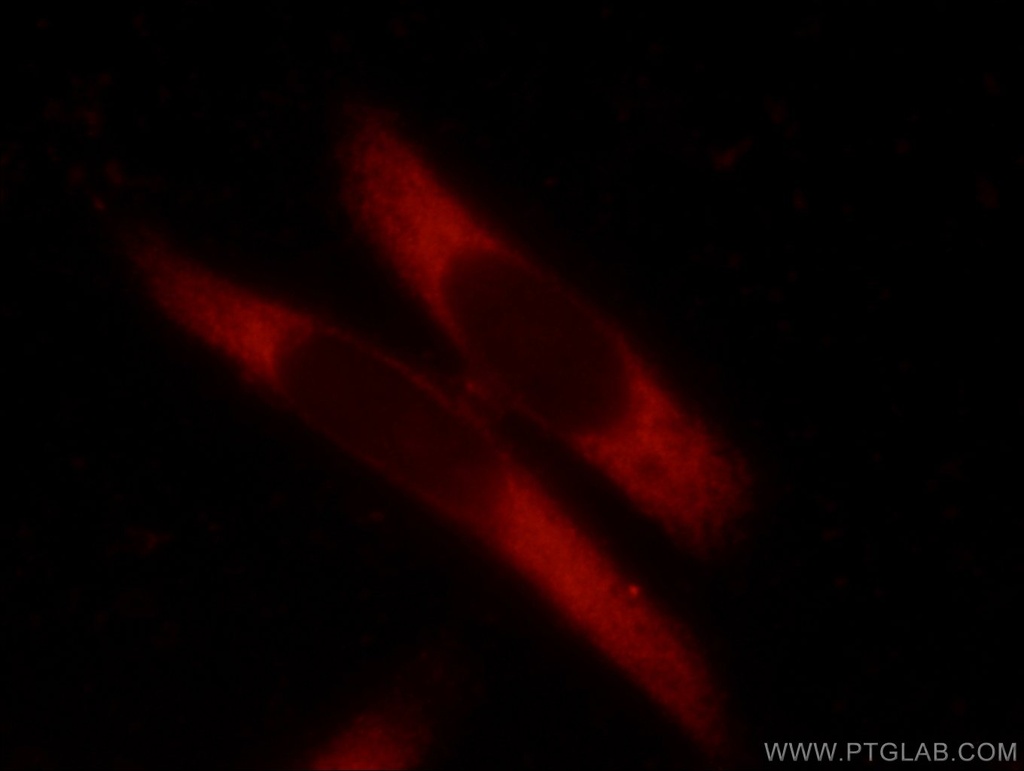 TMEM127 Polyclonal antibody