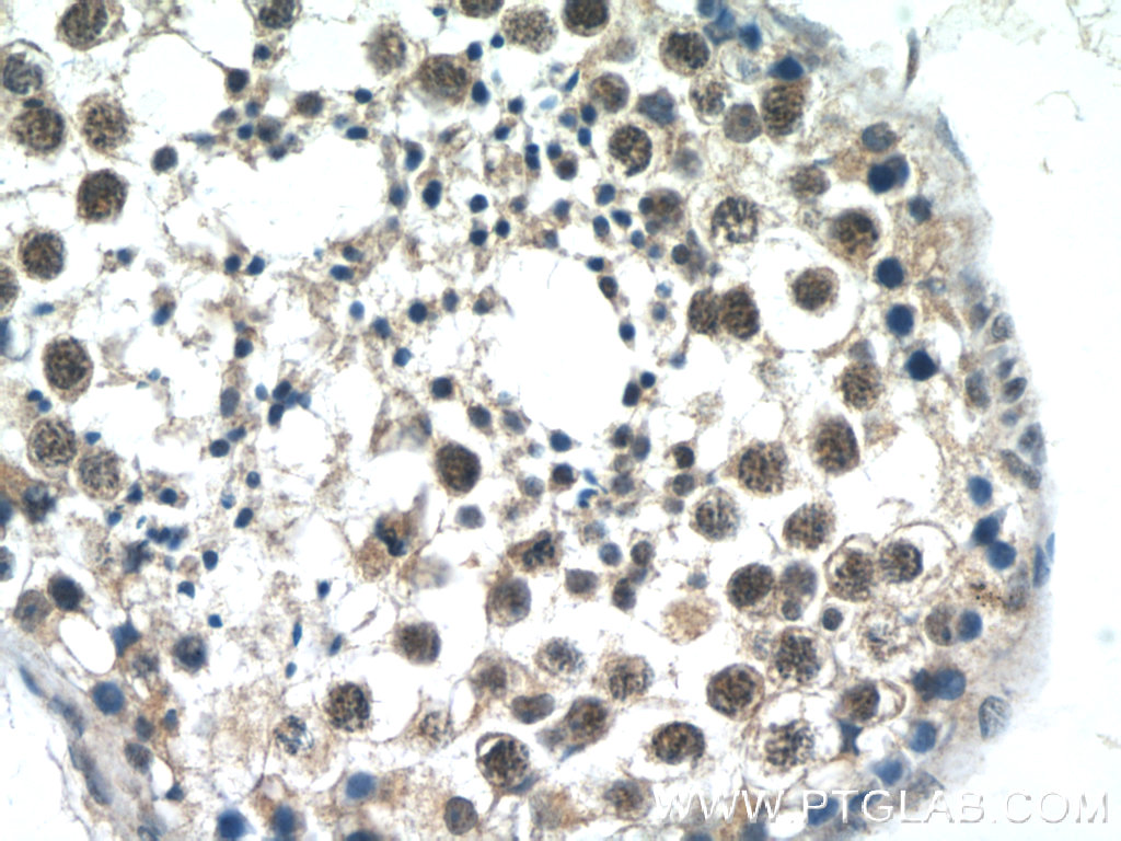 ATXN3L Polyclonal antibody