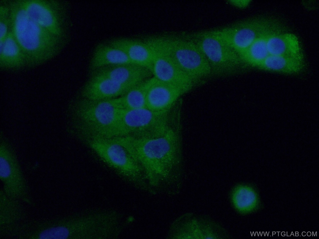RHBDF2 Polyclonal antibody