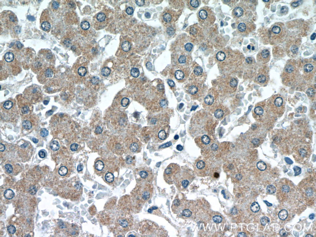 GATC Polyclonal antibody