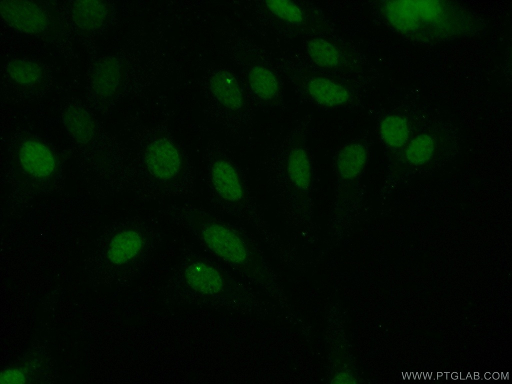 EVI1 Polyclonal antibody