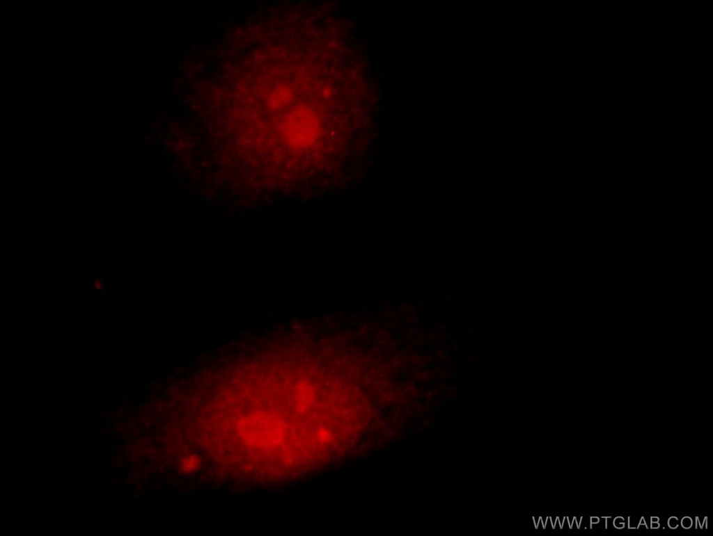Claspin Polyclonal antibody