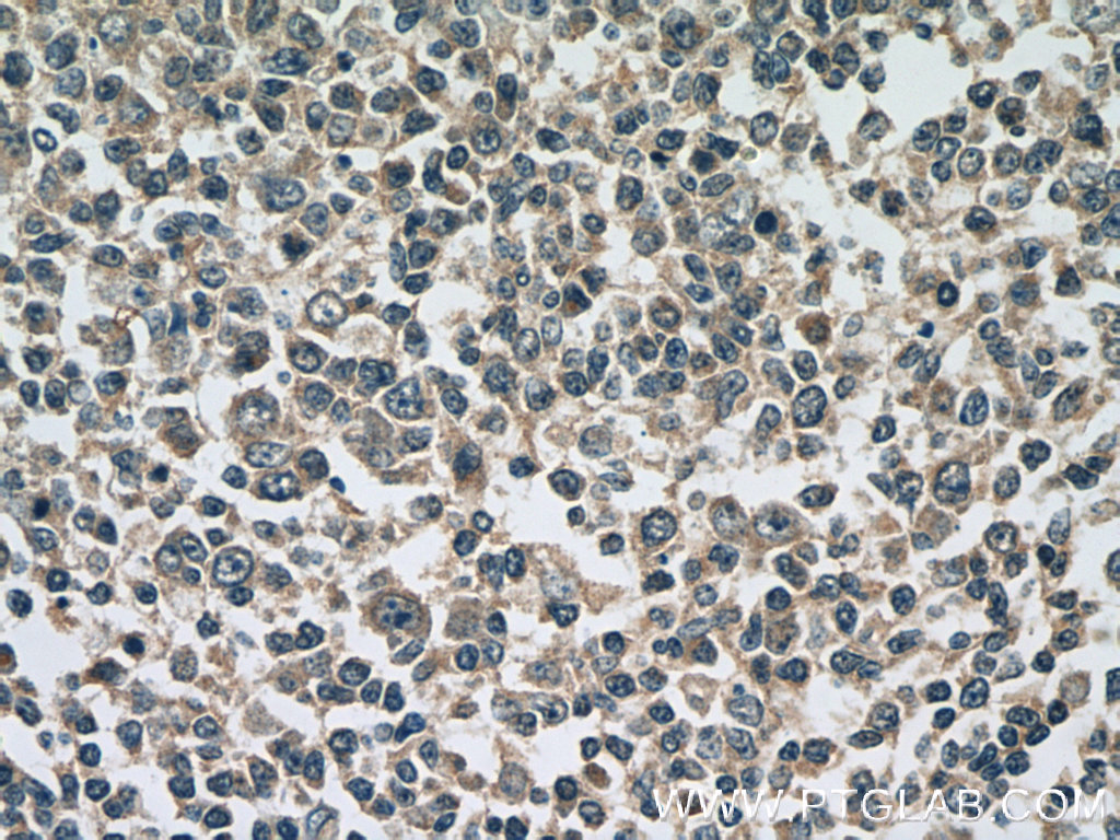 ATG2A Polyclonal antibody