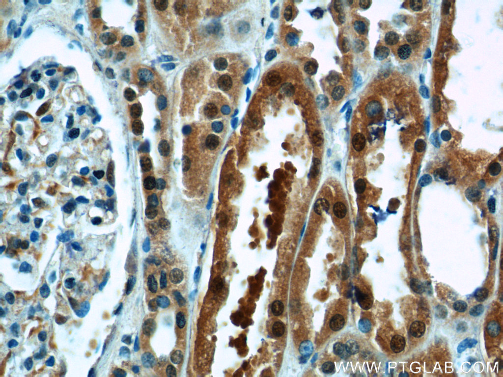 TBX18 Polyclonal antibody