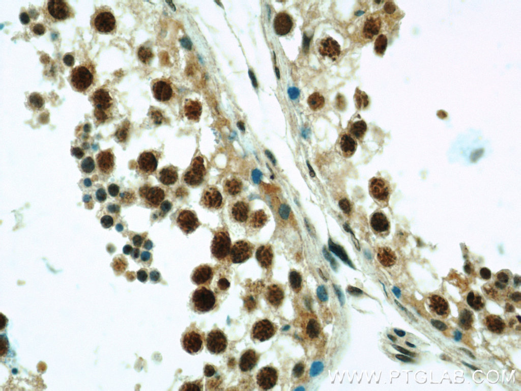 ZNF311 Polyclonal antibody