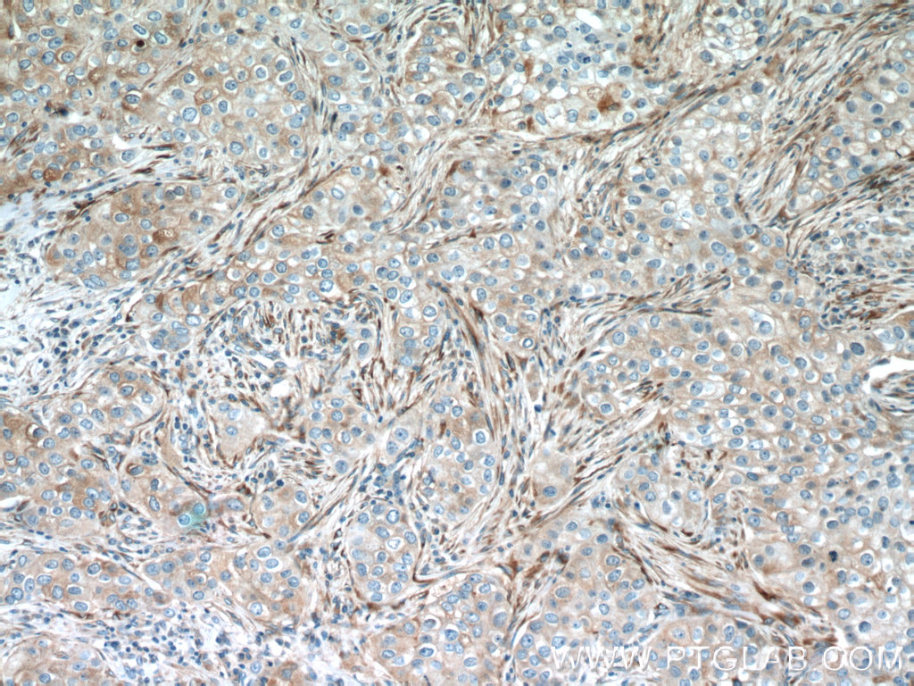 IFIT1 Polyclonal antibody