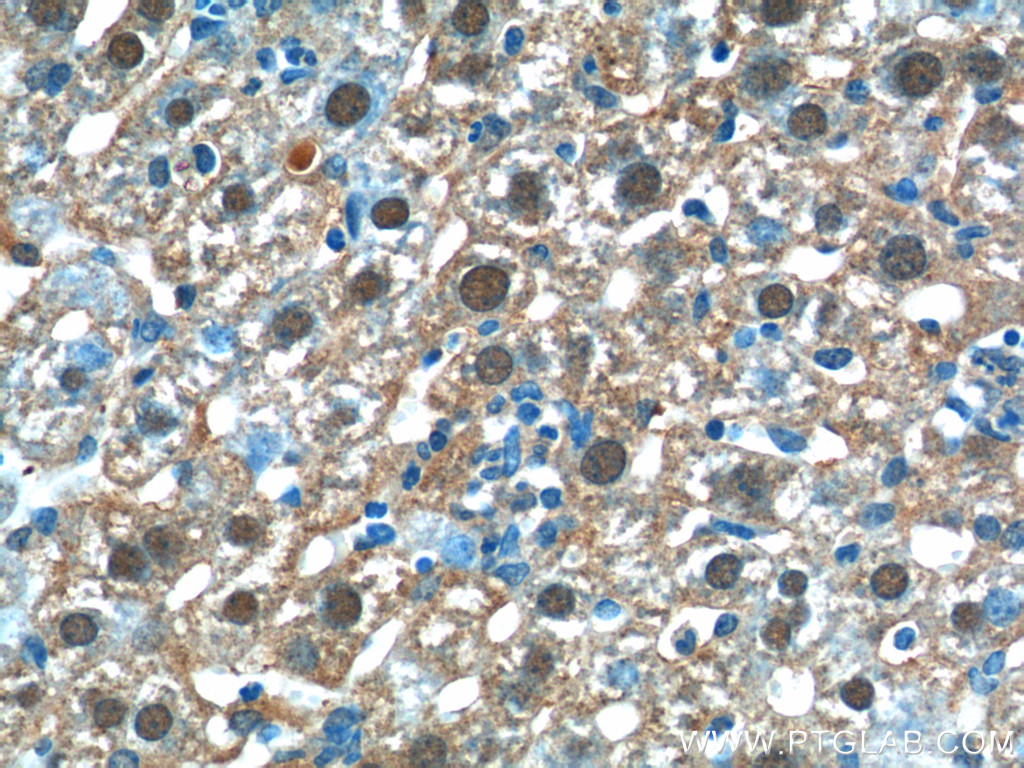 C11orf54 Polyclonal antibody