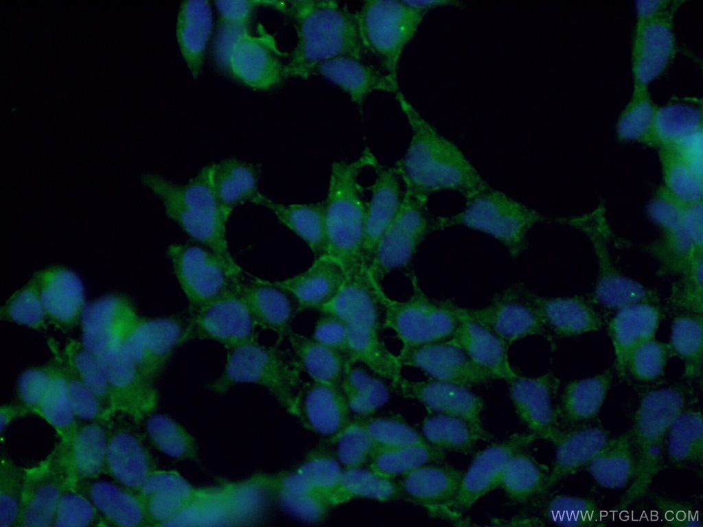 KCNN4 Polyclonal antibody