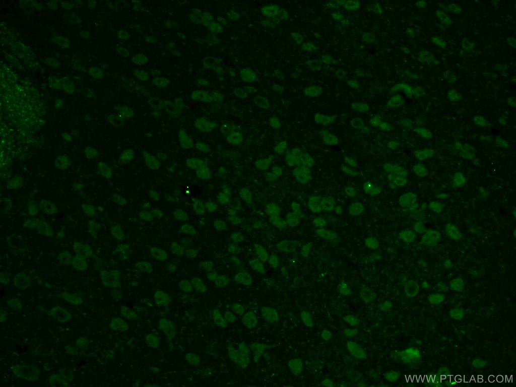 PINK1 Polyclonal antibody