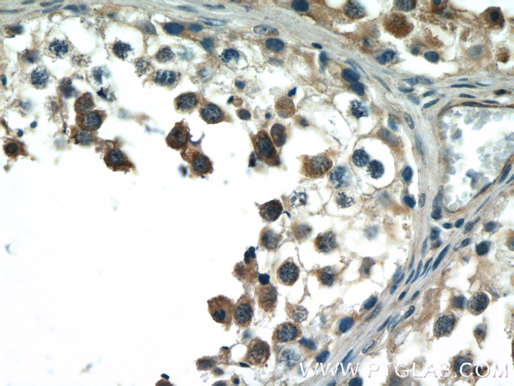 BCMO1 Polyclonal antibody