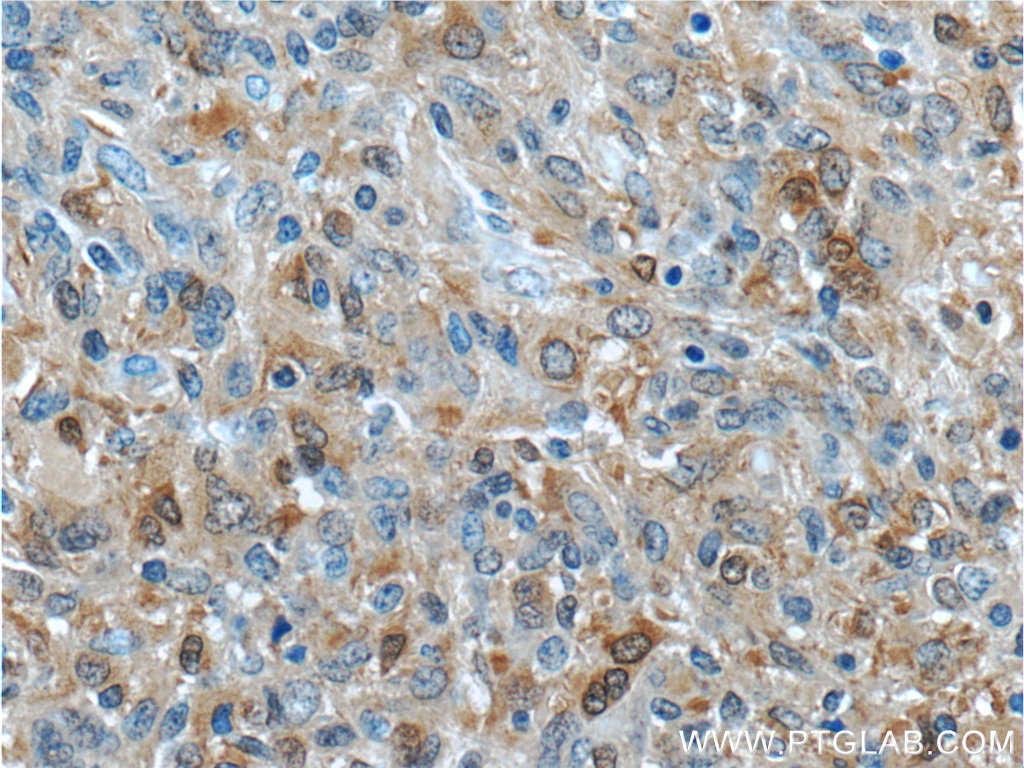 IDH1 Polyclonal antibody