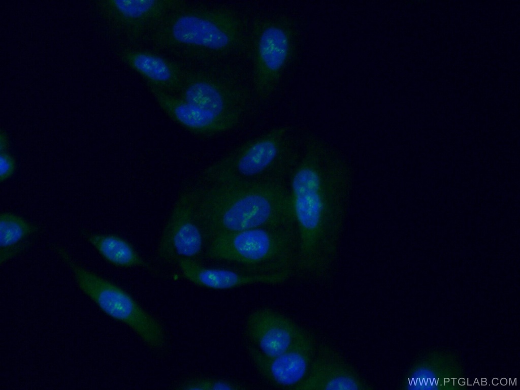 STAG3 Polyclonal antibody