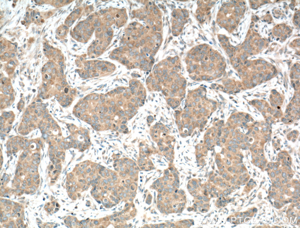CAMLG Polyclonal antibody