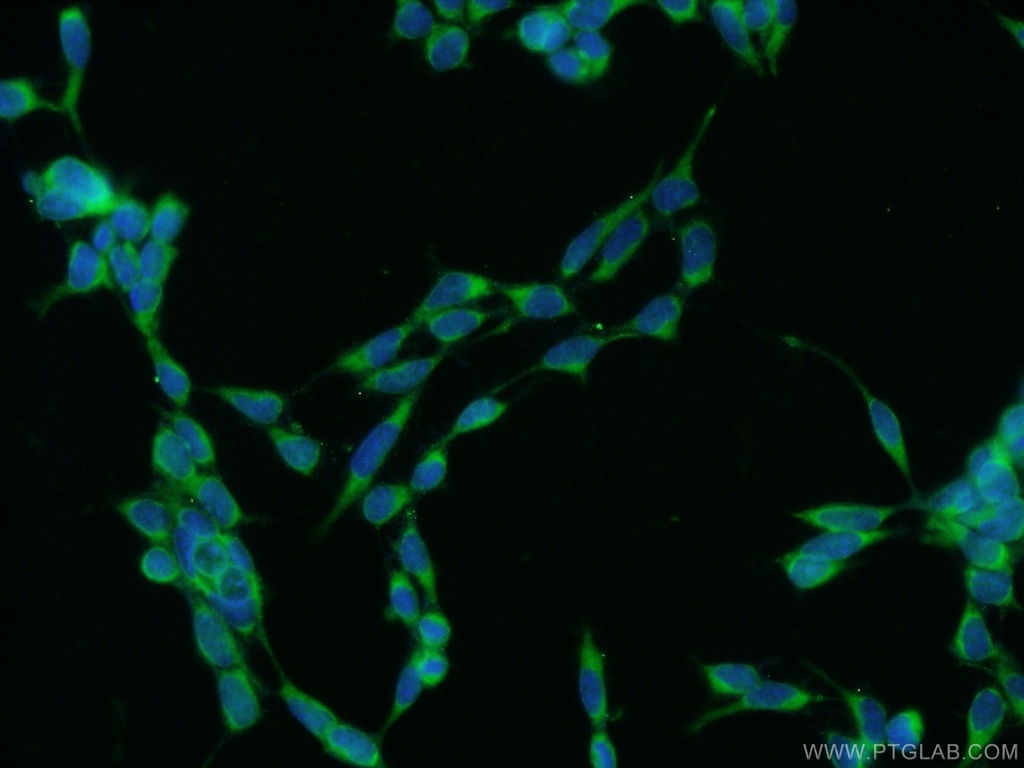 C16orf84 Polyclonal antibody