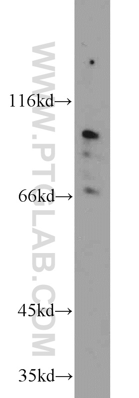 TMTC1 Polyclonal antibody