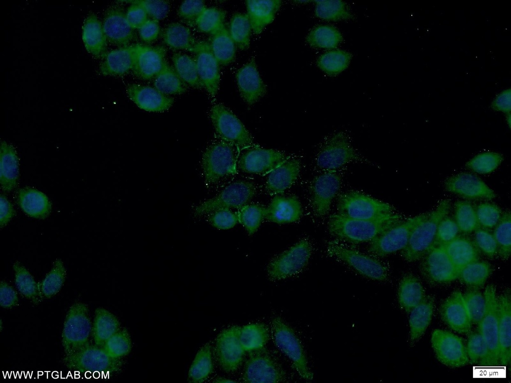 FOLR1 Polyclonal antibody