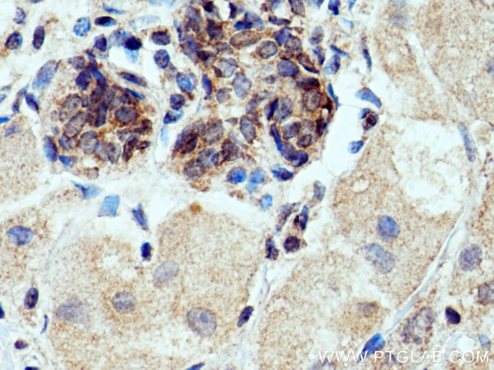 FCHSD1 Polyclonal antibody