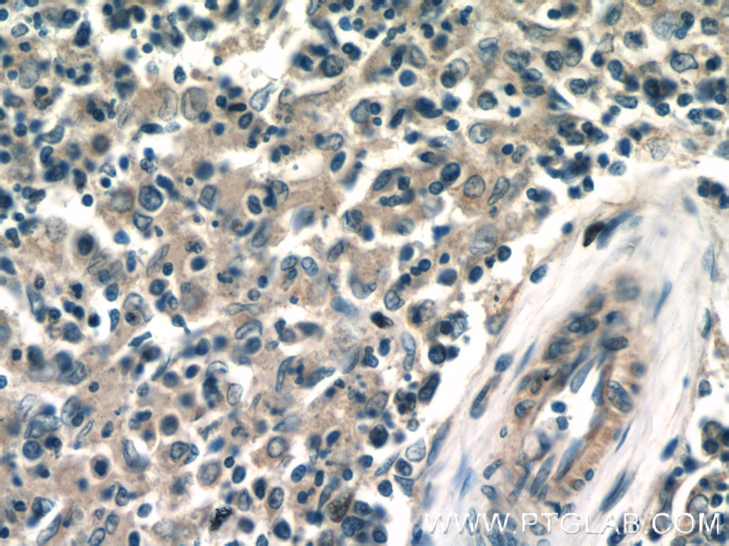 ACOXL Polyclonal antibody