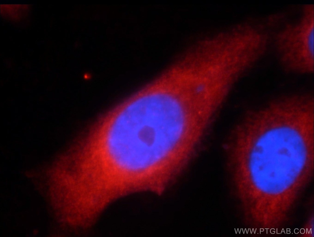 UPF1 Polyclonal antibody