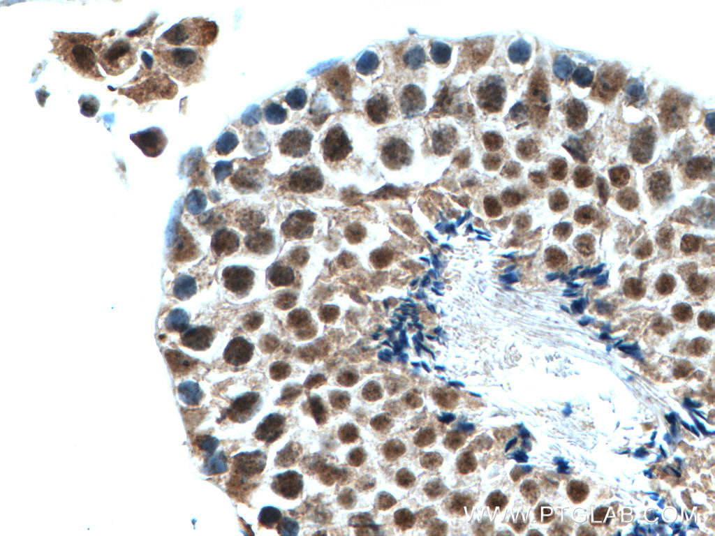 PIAS1 Polyclonal antibody
