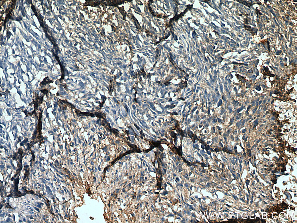 RANKL Polyclonal antibody