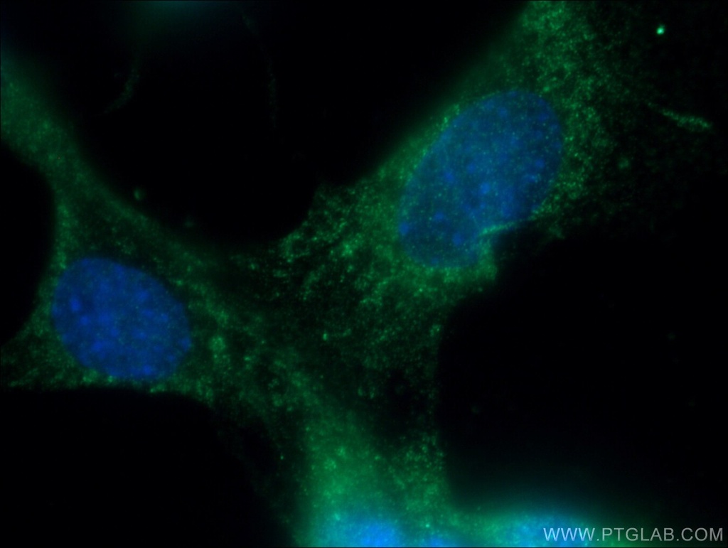 Osteocalcin Polyclonal antibody