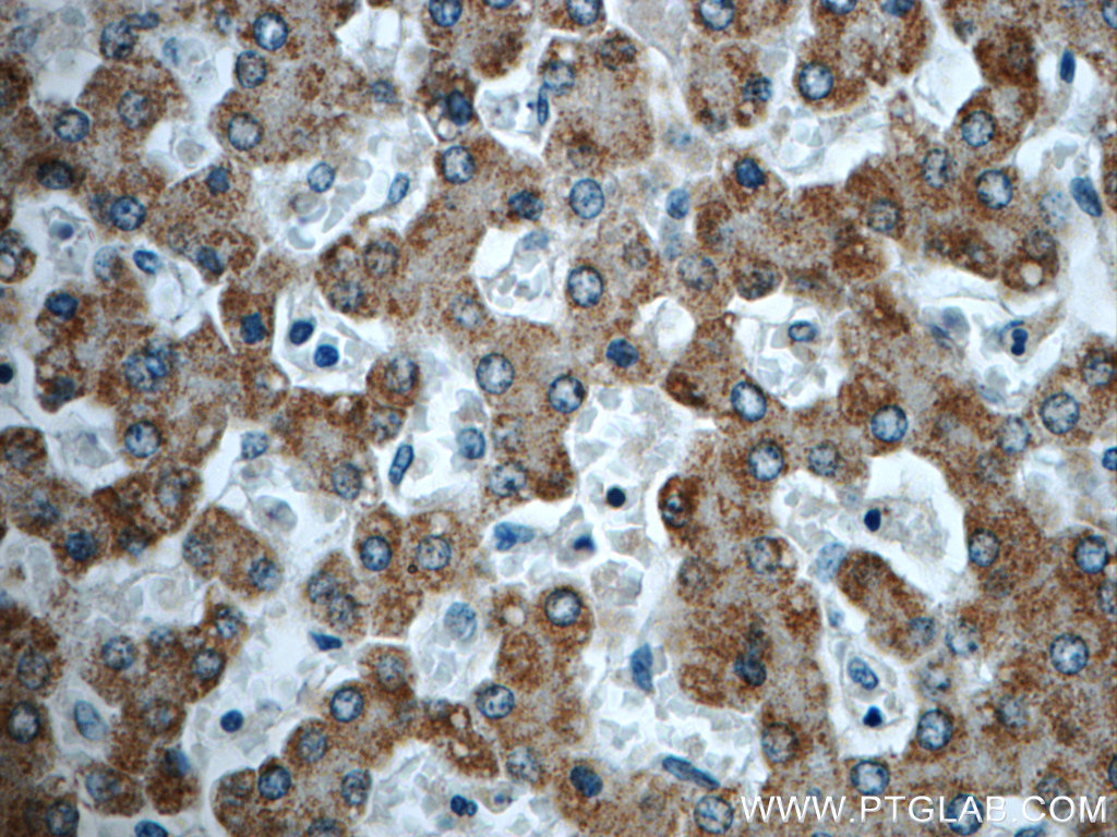 TTC39B Polyclonal antibody