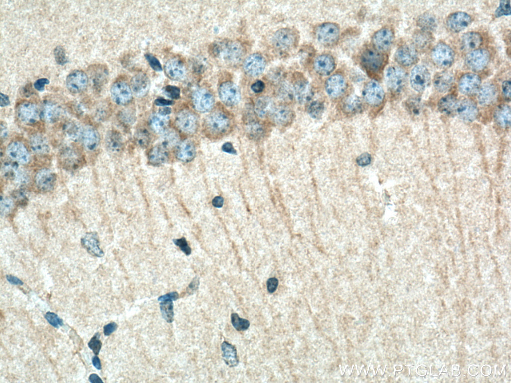 PHACTR1 Polyclonal antibody