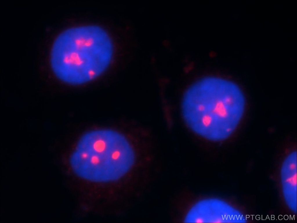 ESF1 Polyclonal antibody