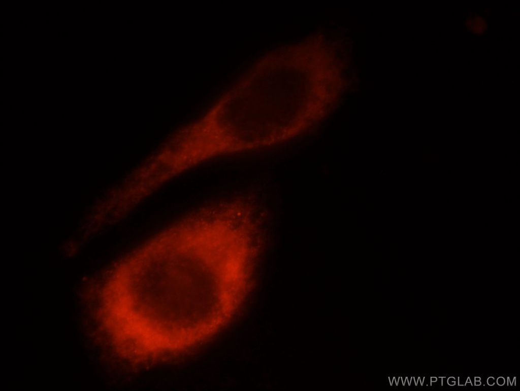 Laminin beta 1 Polyclonal antibody