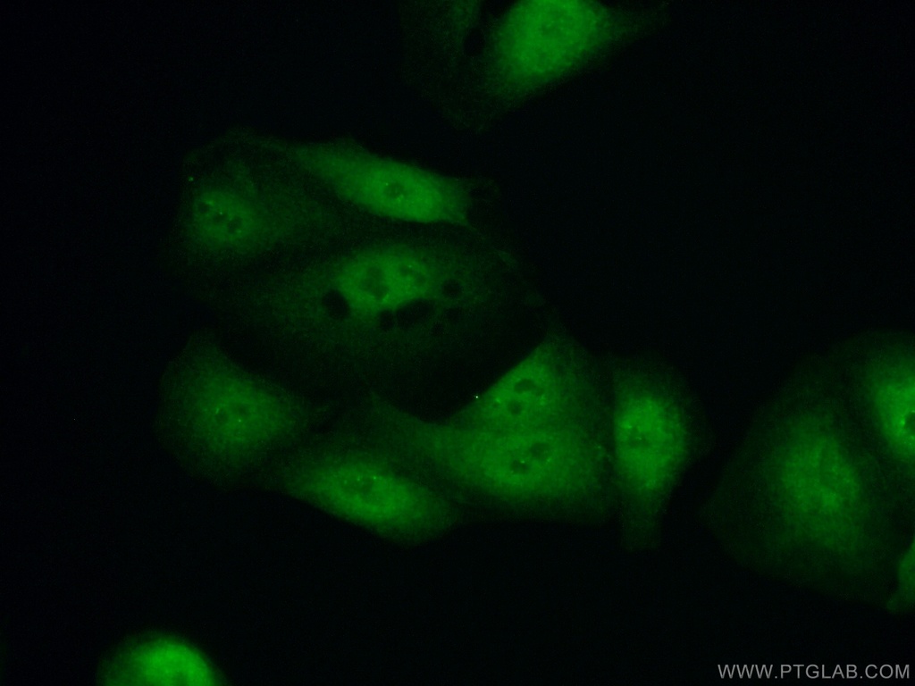 HOXD13 Polyclonal antibody