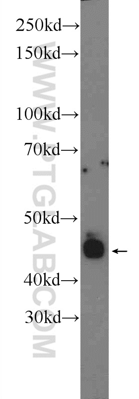Retinal S antigen Polyclonal antibody