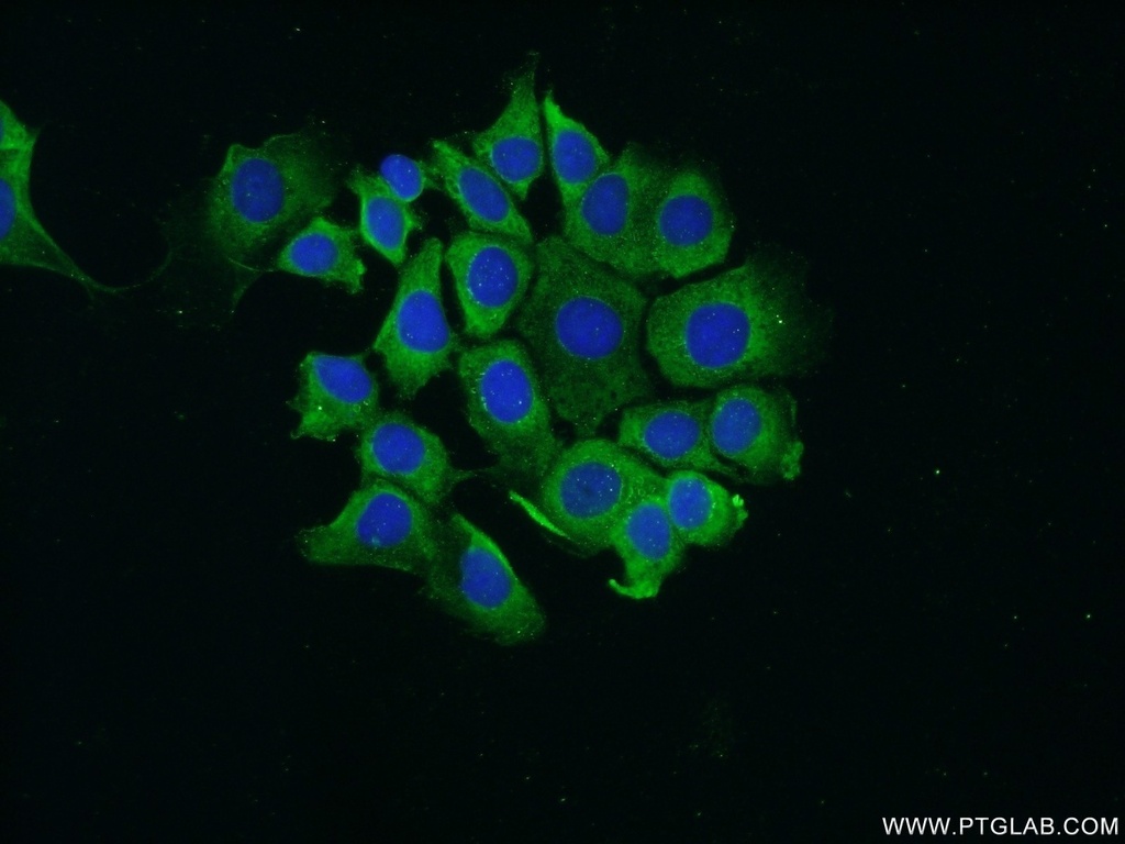 RPS25 Polyclonal antibody