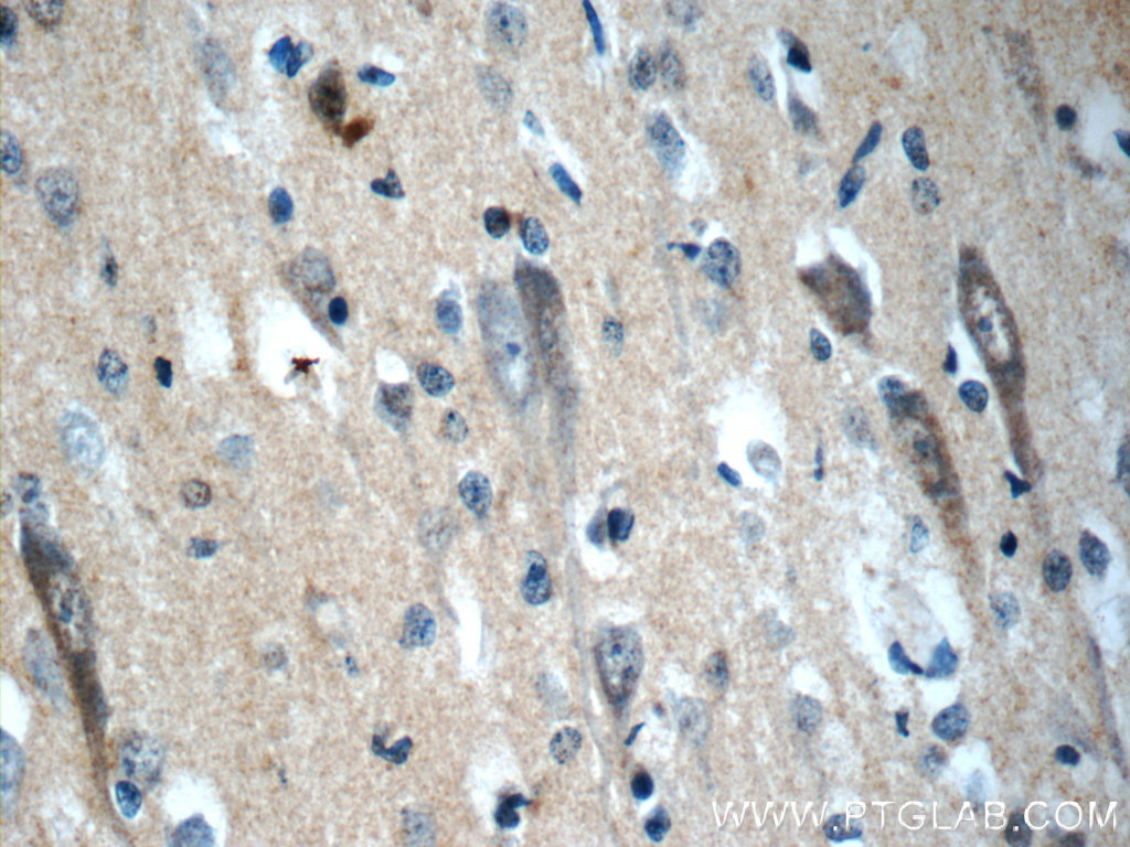NPS Polyclonal antibody