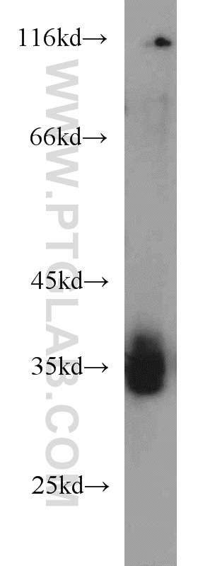 TIMMDC1 Polyclonal antibody